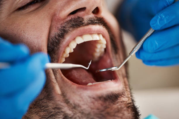Best Emergency Treatment for Oral Infections in Hybla Lley, VA