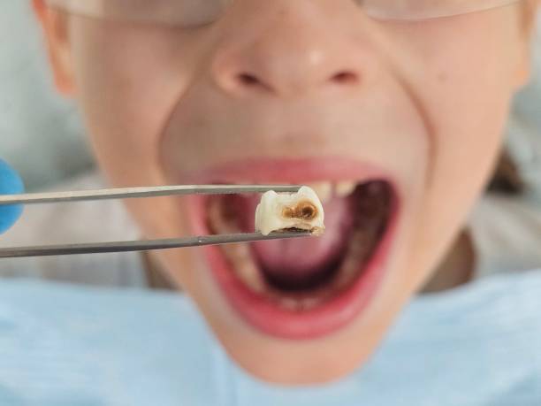 Best Walk-In Emergency Dental Services in Hybla Lley, VA